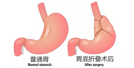 普外科 配图2.png